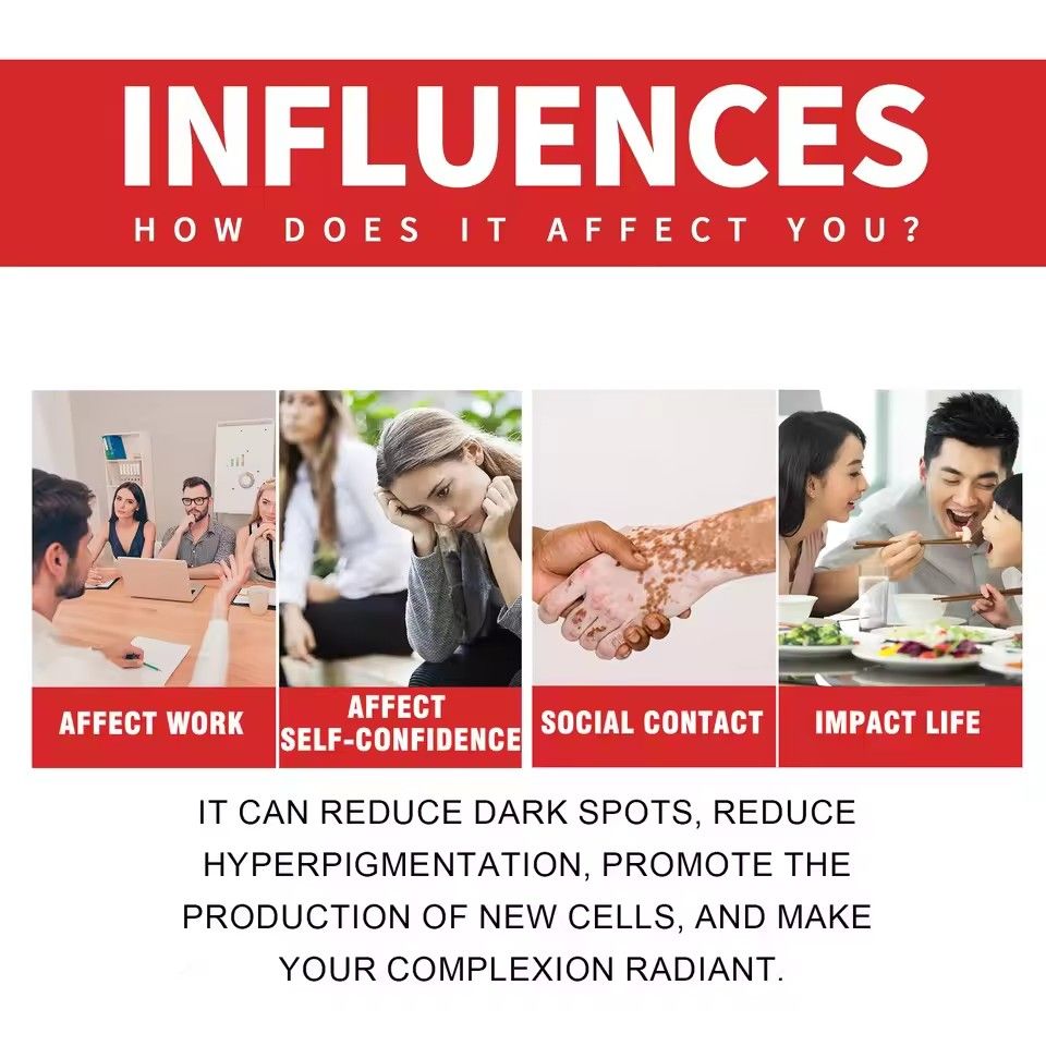 Brightening Face Cream Pigments Removal Firming Nourishing Fade Dark Blemishes Lightening Glow Skin Care Products Beauty Health