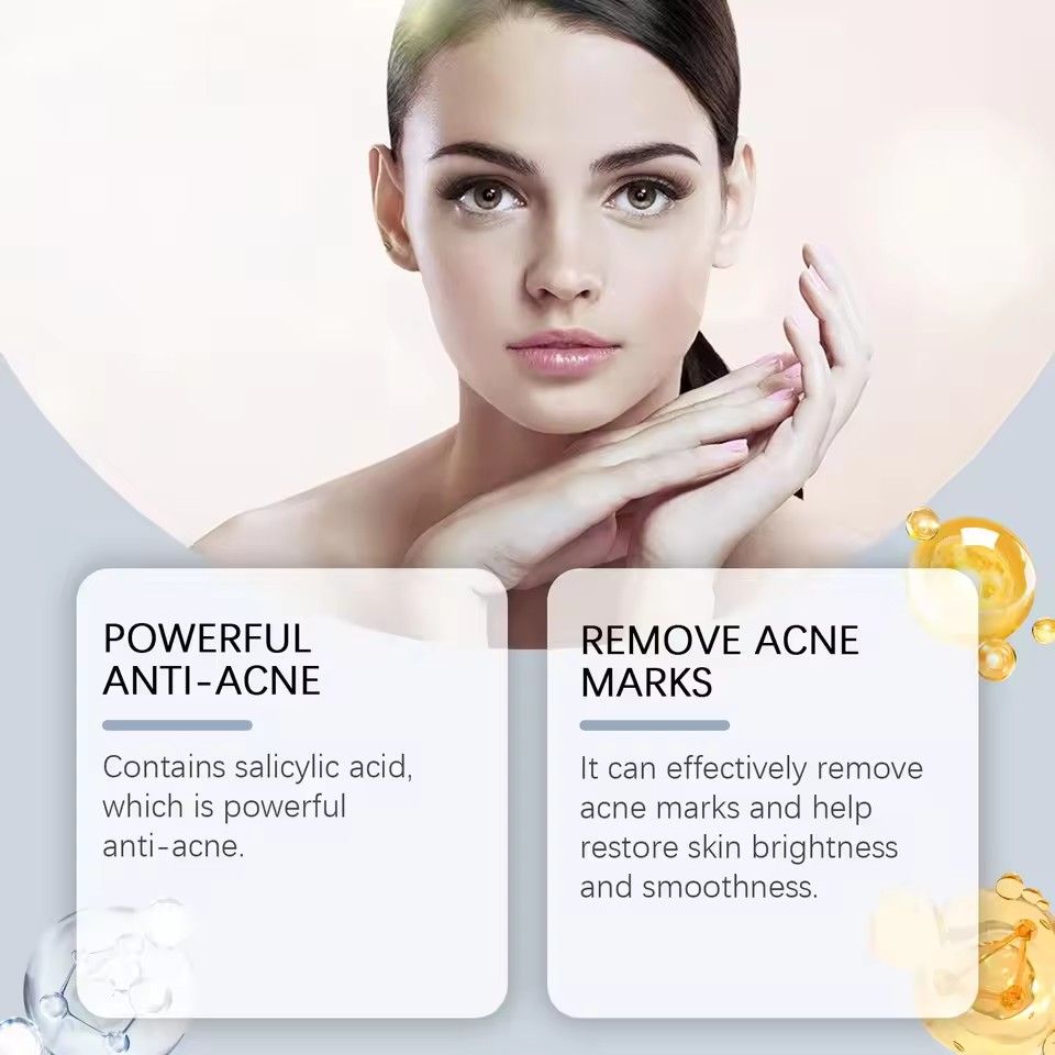 Salicylic Acid Serum Anti Acne Reduce Breakouts Fading Blemishes Shrink Pores Smoothing Repairing Pimples Removal Facial Essence