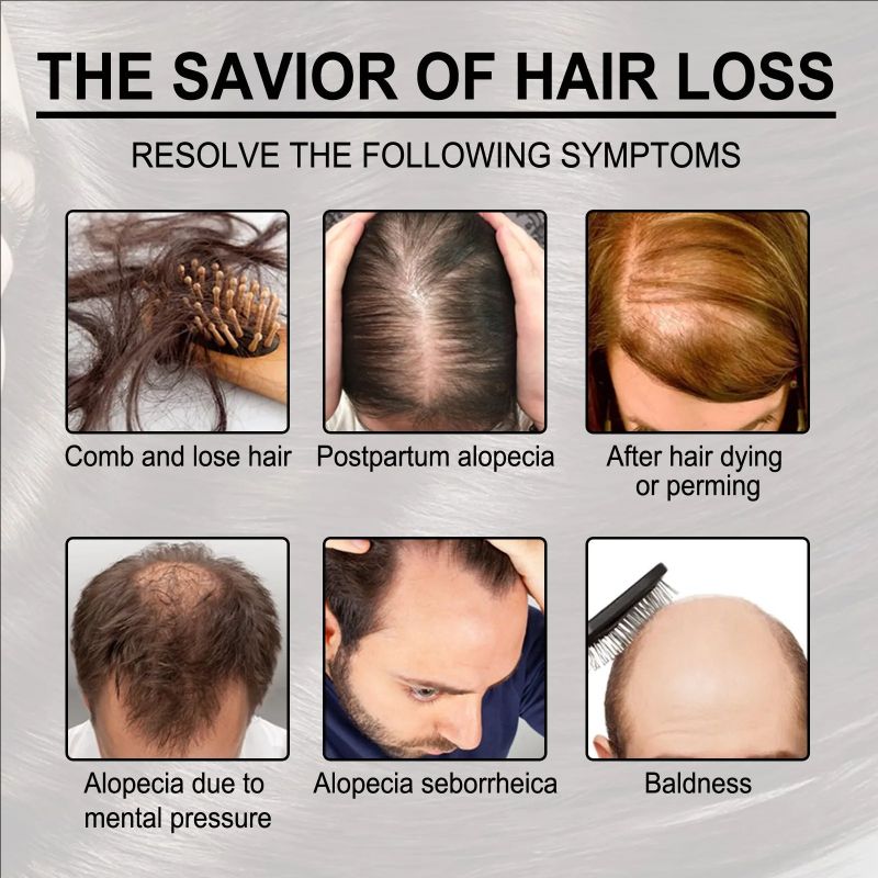 Anti Hair Loss Shampoo Repair Baldness Reduce Dandruff Itching Scalp Treatment Strengthen Thicken Nourishing Hair Growth Shampoo