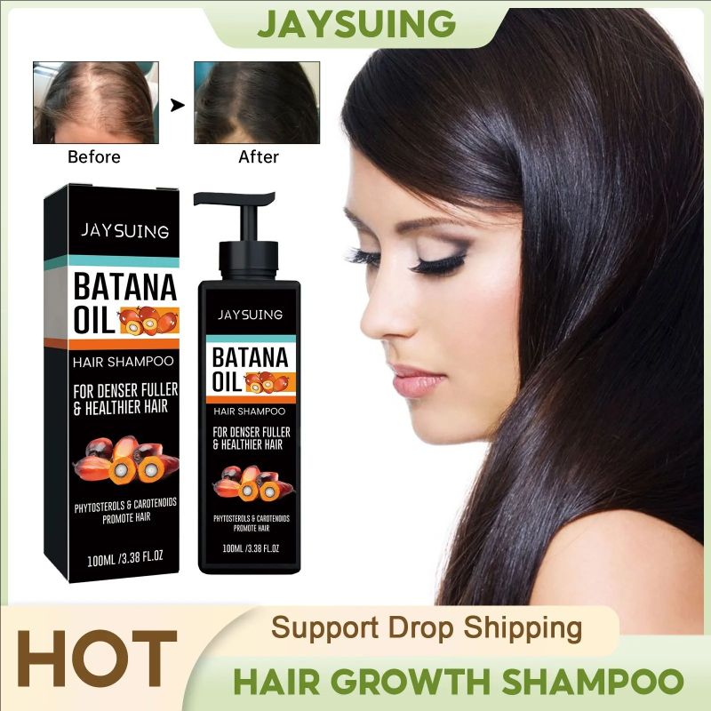 Anti Hair Loss Shampoo Repair Baldness Reduce Dandruff Itching Scalp Treatment Strengthen Thicken Nourishing Hair Growth Shampoo