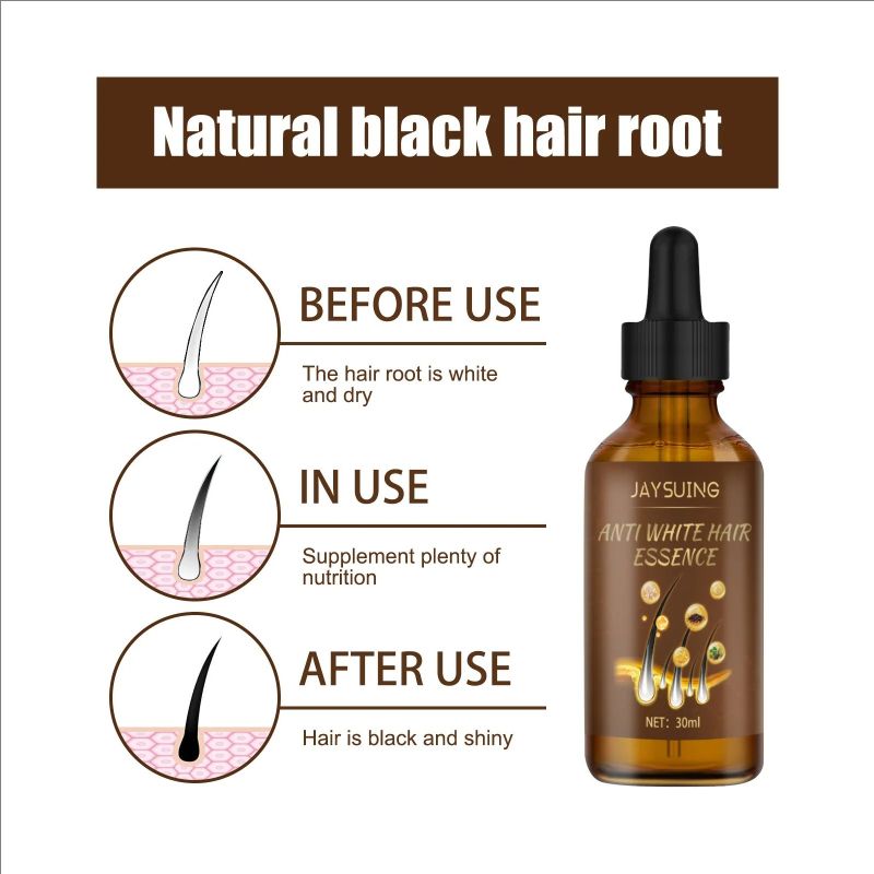 Jaysuing Anti White Hair Serum Gray To Black Repair Scalp Nourish Hair Blacken Serum Reduce Gray Hair Darkening Growth Essence