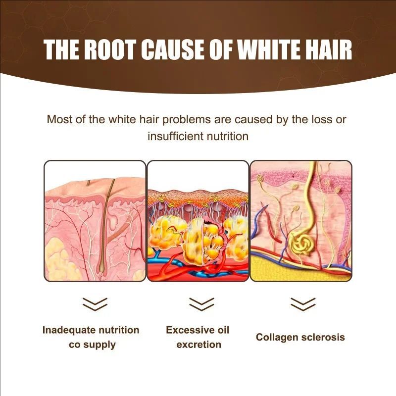 Jaysuing Anti White Hair Serum Gray To Black Repair Scalp Nourish Hair Blacken Serum Reduce Gray Hair Darkening Growth Essence