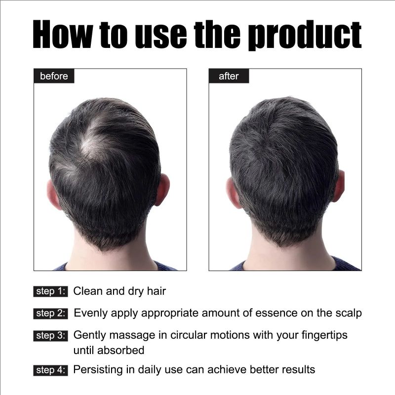 Hair Growth Liquid Nourishes Hair And Repairs Damaged Hair Refreshing And Non Greasy Hair Care Liquid 30ml