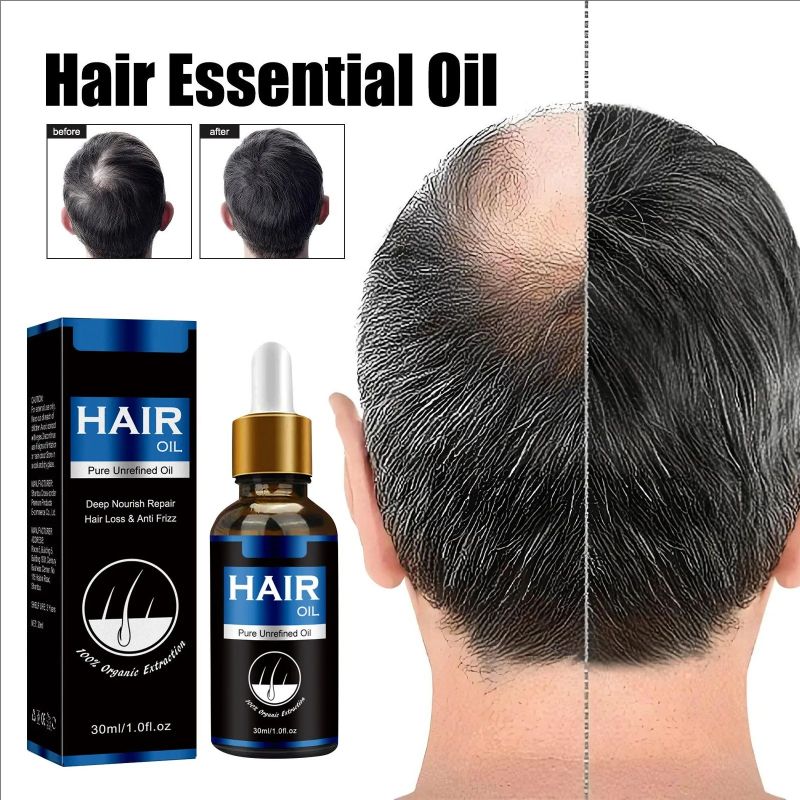 Hair Growth Liquid Nourishes Hair And Repairs Damaged Hair Refreshing And Non Greasy Hair Care Liquid 30ml