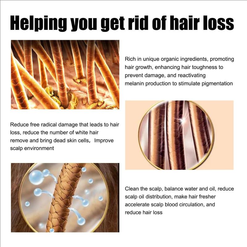 Hair Growth Liquid Nourishes Hair And Repairs Damaged Hair Refreshing And Non Greasy Hair Care Liquid 30ml