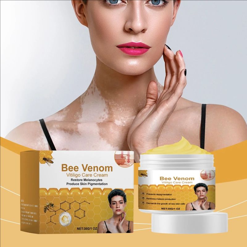 Vitiligo Repairing Cream, Even Skin Tone, Promote Melanin And Improve White Skin Care Cream