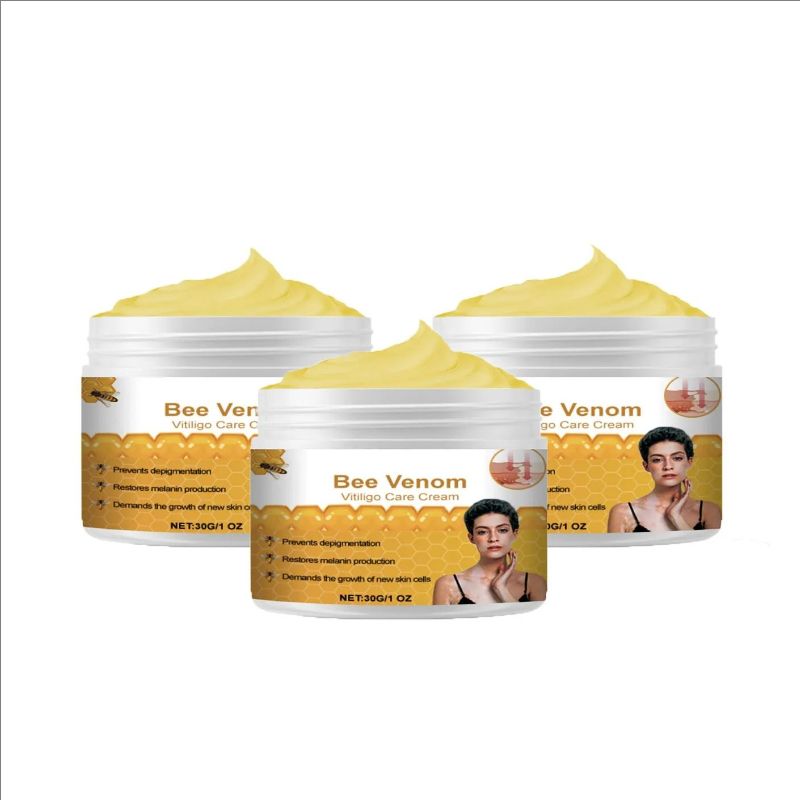 Vitiligo Repairing Cream, Even Skin Tone, Promote Melanin And Improve White Skin Care Cream