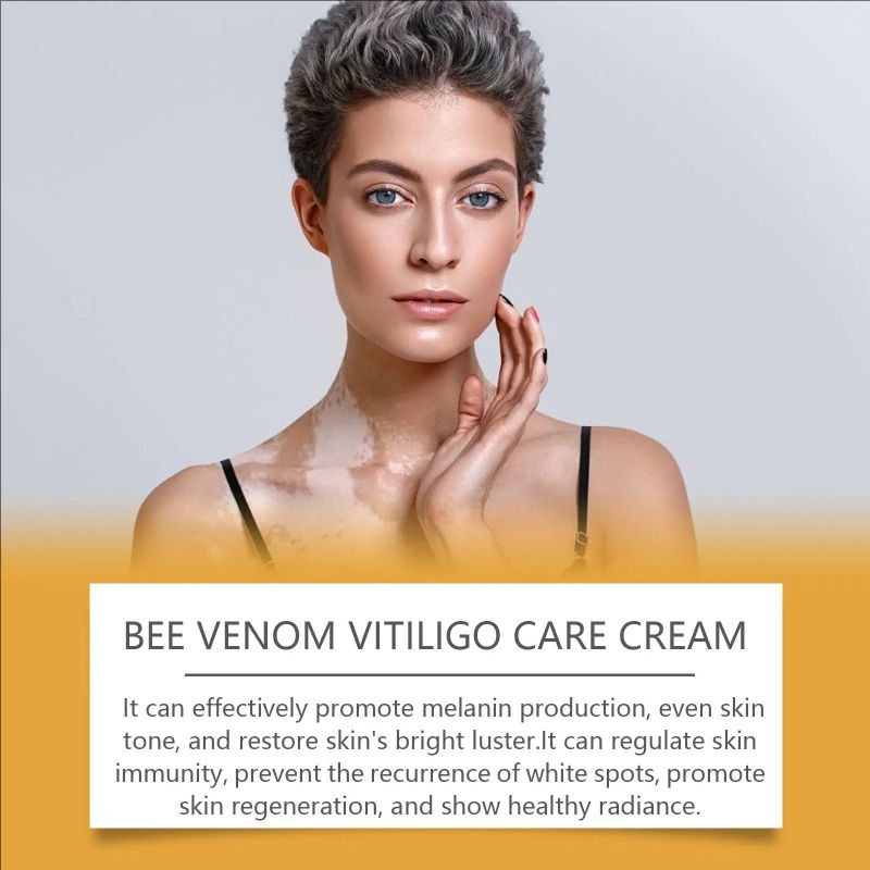 Vitiligo Repairing Cream, Even Skin Tone, Promote Melanin And Improve White Skin Care Cream