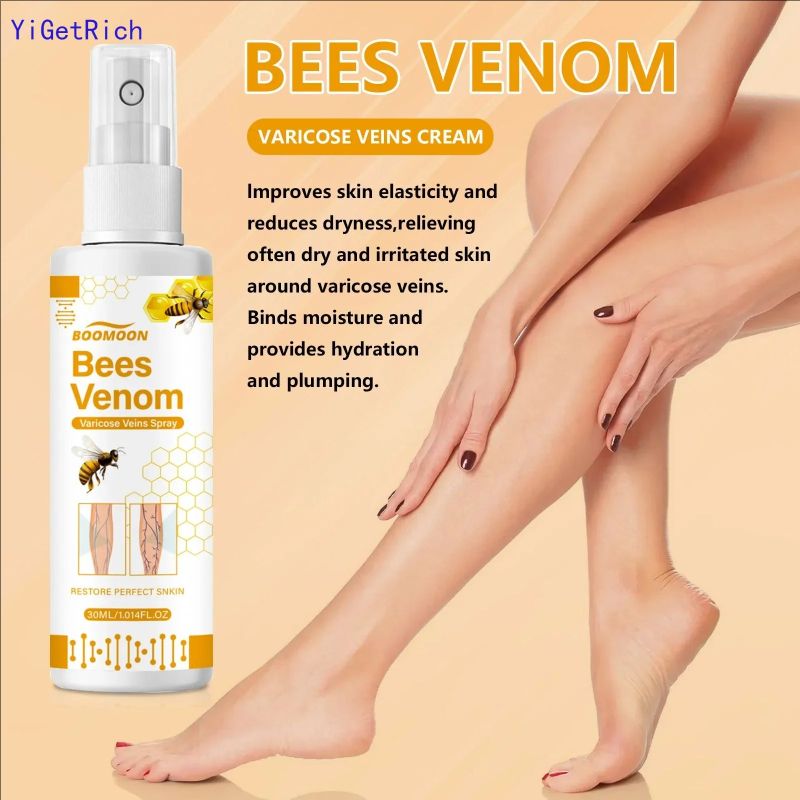 30ml Varicose Veins Spray For Removing Varicose Gifts Veins Spider Veins Removal Spray Varicose Veins Spray To Leg Pain