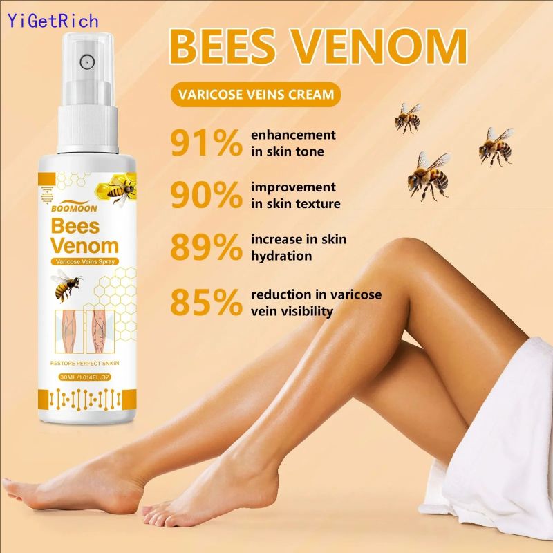 30ml Varicose Veins Spray For Removing Varicose Gifts Veins Spider Veins Removal Spray Varicose Veins Spray To Leg Pain