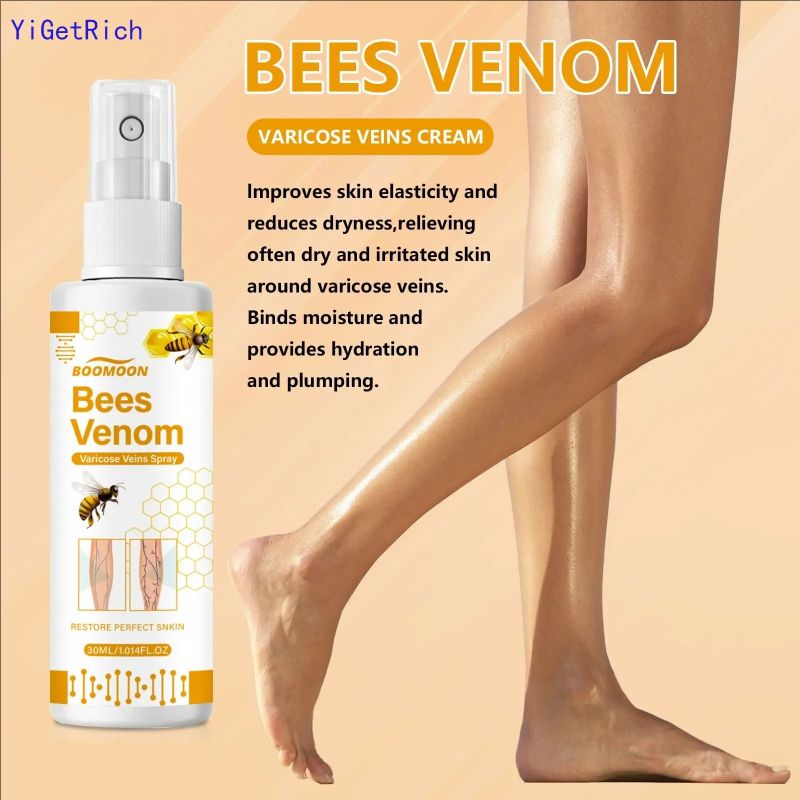 30ml Varicose Veins Spray For Removing Varicose Gifts Veins Spider Veins Removal Spray Varicose Veins Spray To Leg Pain
