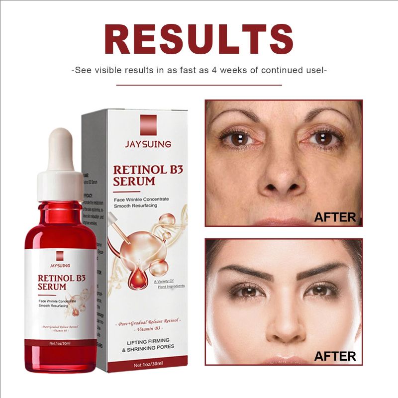30ml B3 Retinol Beauty Face Serum Fade Fine Lines Moisturizing Brighten Face Color Firming Hydrating Facial Serum Skincare