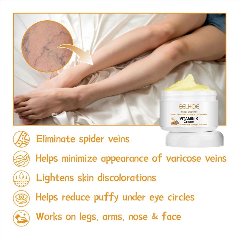 Effective Varicose Vein Relief Cream For Varicose Veins Relieve Vasculitis Phlebitis Spider Pain Ointment For Men Women