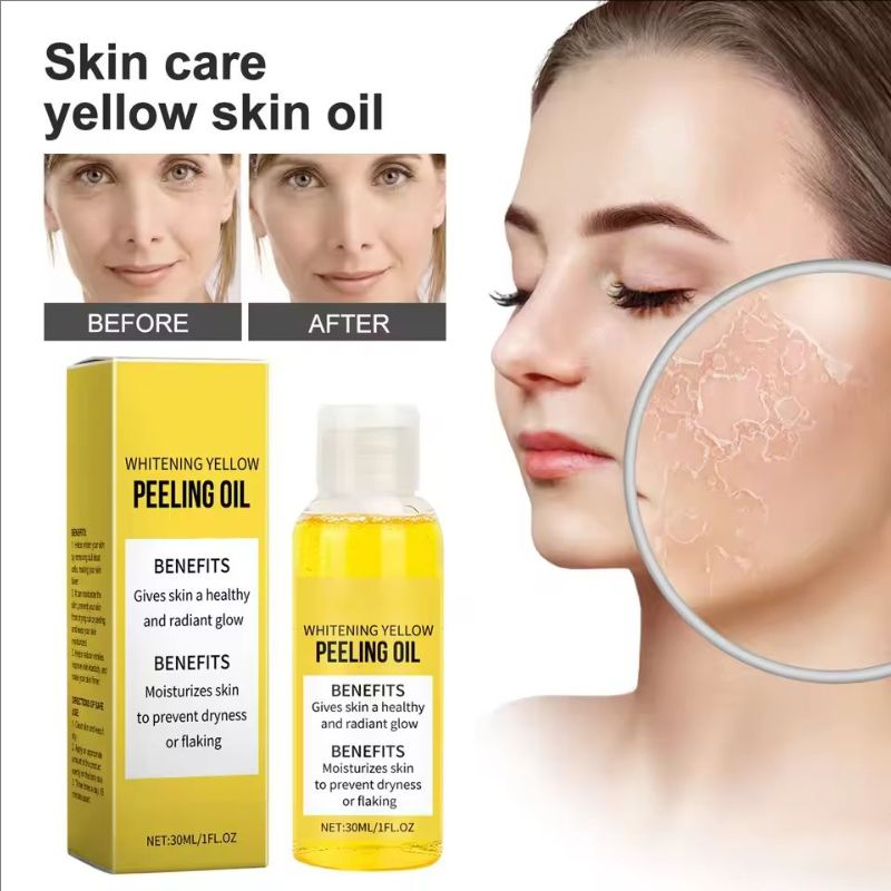 Yellow Peeling Oil Skin Oil Whitening Body Oil Nourishing And Brightening Skin Care Oil Improves Skin Tone Uniformity Exfoliator