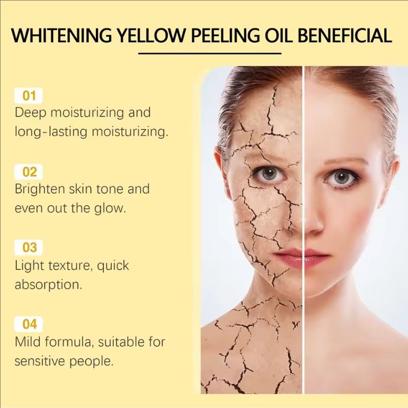 Yellow Peeling Oil Skin Oil Whitening Body Oil Nourishing And Brightening Skin Care Oil Improves Skin Tone Uniformity Exfoliator