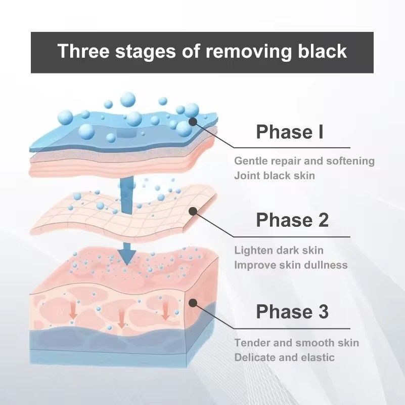 Whitening Body Cream Remove Deposited Melanin Repairing Underarm Elbow Joint Dark Spot Pigmentation Brightening Bleaching Cream