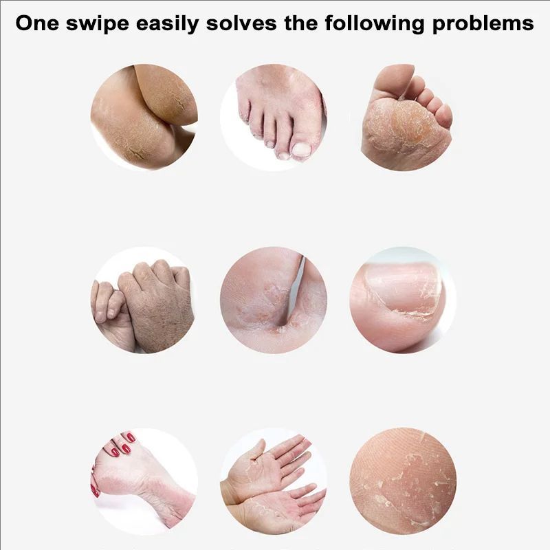 Anti Crack Foot Cream Anti-Drying Smooth Horse Oil Removal Dead Skin Callus Hand Feet Skin Care Autumn Winter Moisturizing Cream
