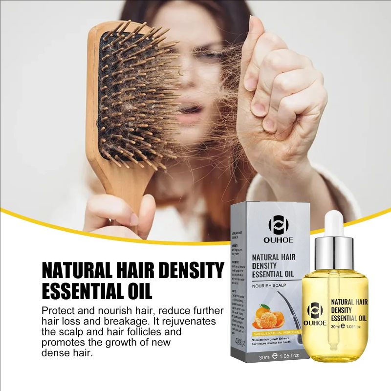 Hair Growth Essential Oil Treatment Seborrheic Alopecia Follicle Repairing Reduce Hairline Baldness Dense Grow Fast Hairs Lotion