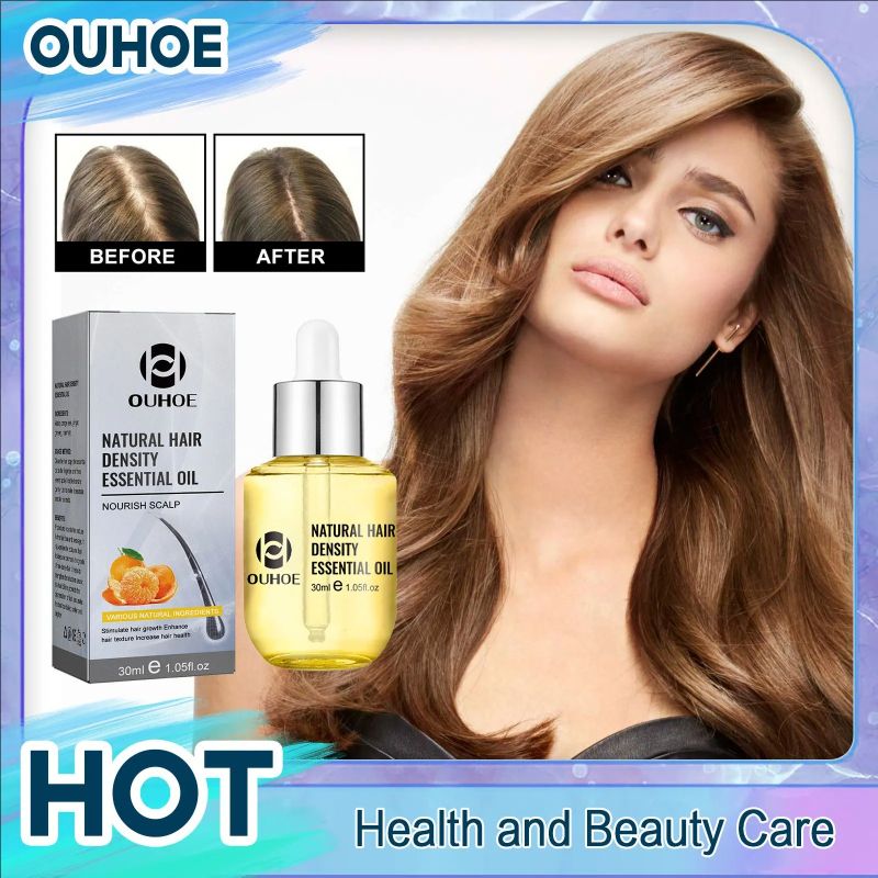 Hair Growth Essential Oil Treatment Seborrheic Alopecia Follicle Repairing Reduce Hairline Baldness Dense Grow Fast Hairs Lotion