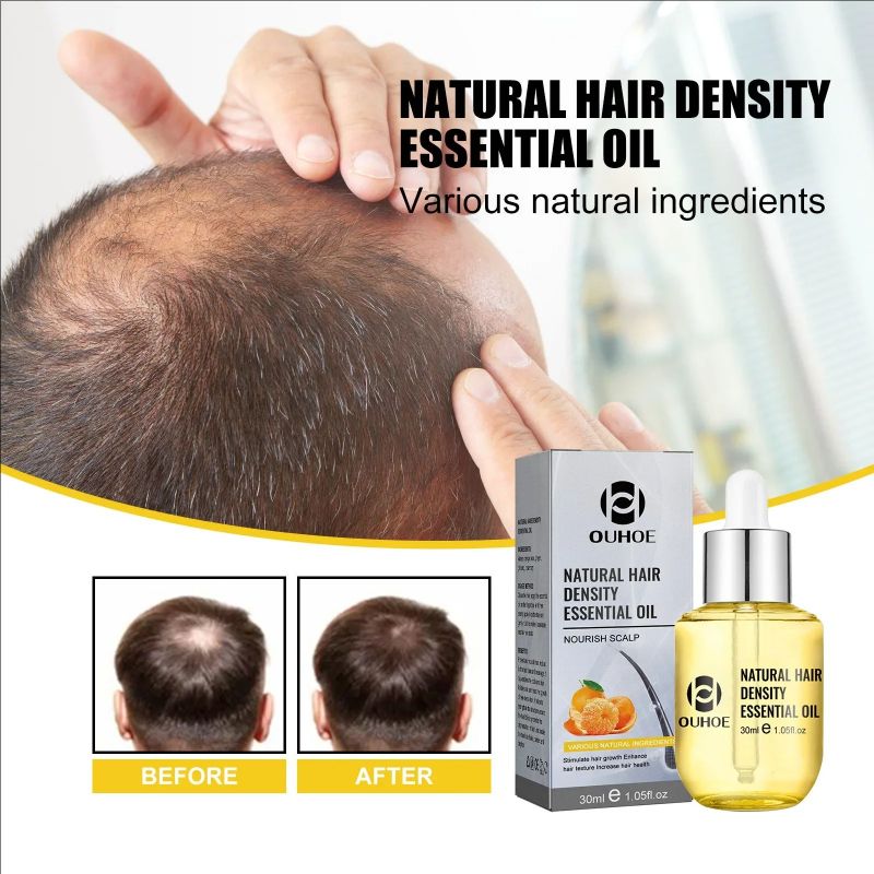 Hair Growth Essential Oil Treatment Seborrheic Alopecia Follicle Repairing Reduce Hairline Baldness Dense Grow Fast Hairs Lotion