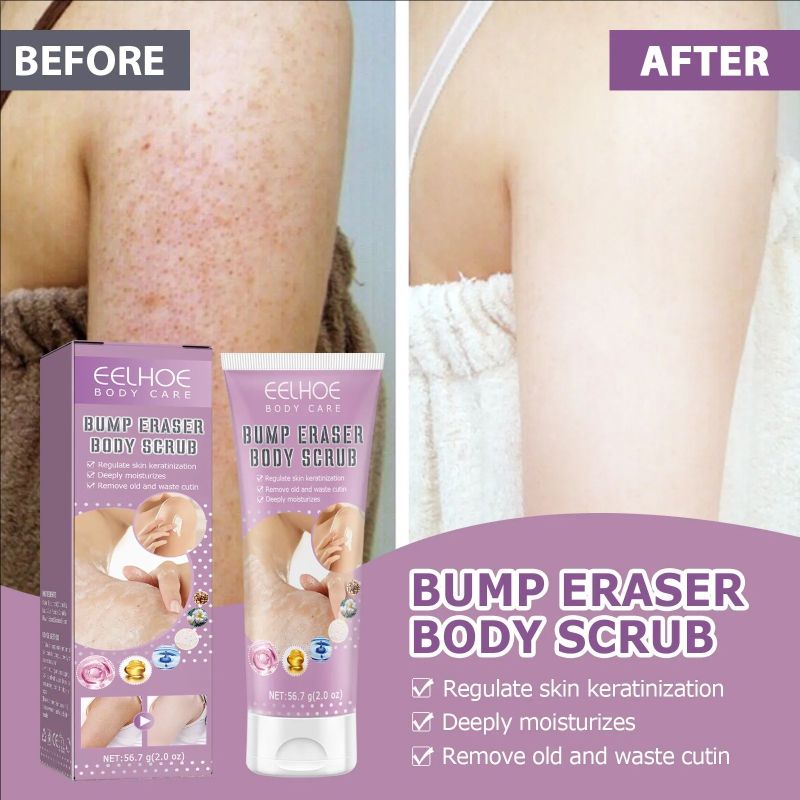 Body Scrub, Suitable For Hair Keratosis Rough Body Scrub Smooth And Comfortable