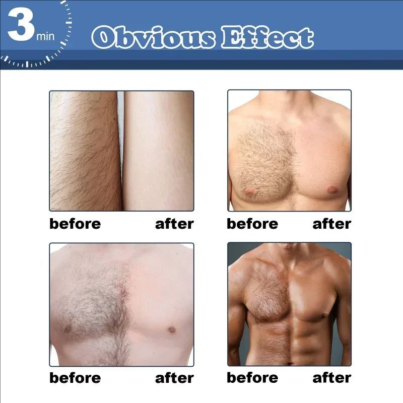 Men's hair removal cream chest hair Legs Arms armpit Beard remover Body Skin Beauty for man Painless Permanent depilation wax