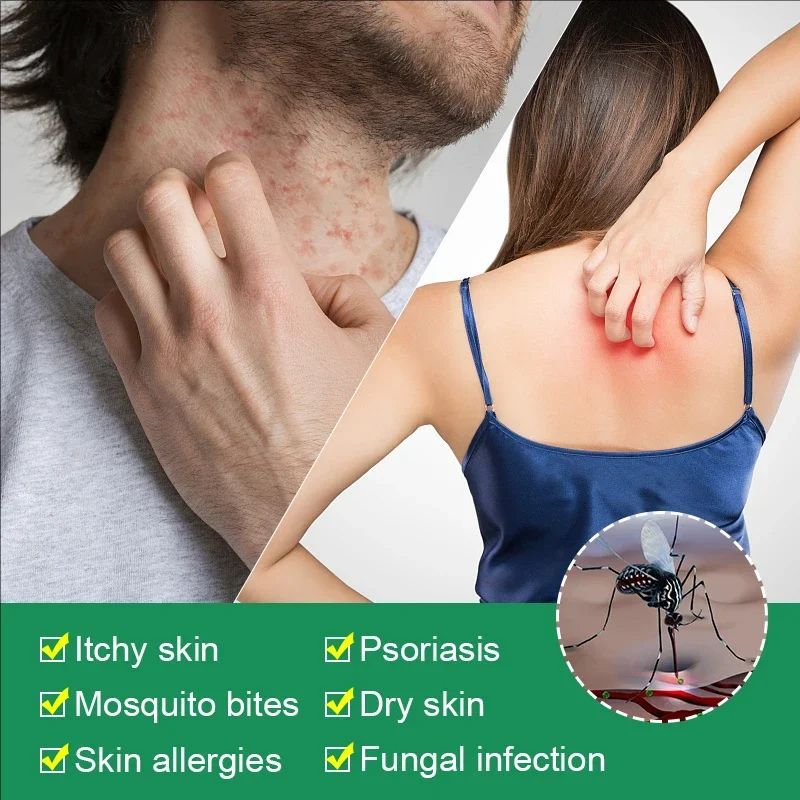 4pcs Thailand Skin Treatment Ointment Psoriasis Cream Anti-itch Repair Damaged Skin Mint Cooling Cream Dermatitis Eczema S074