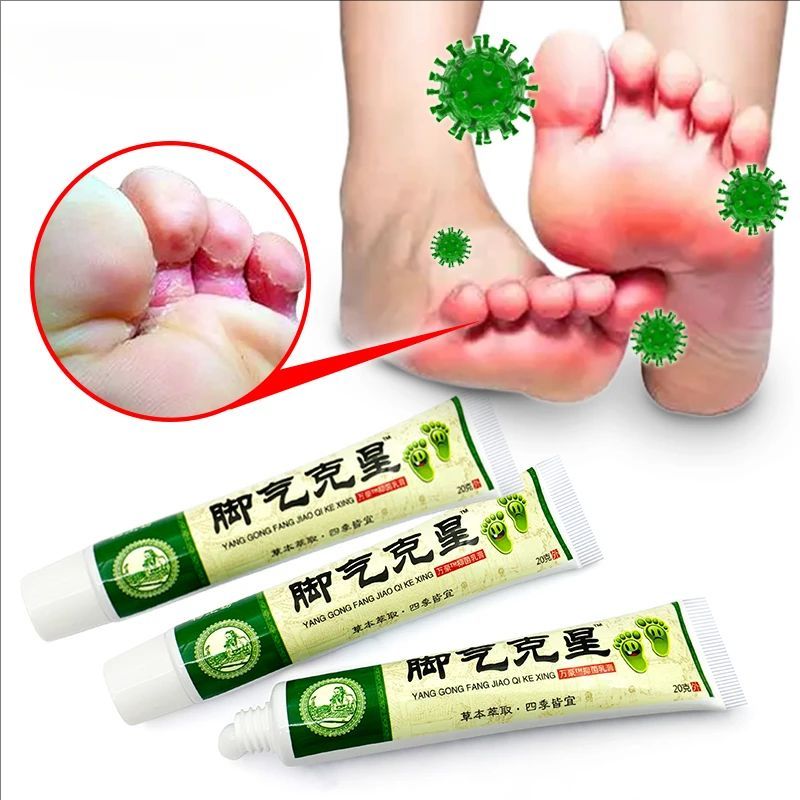 Foot Tinea Pedis Treatment Cream Treat Beriberi Ointment Anti-itch Inhibits Fungus Peeling Athlete Foot Medical Cream A942