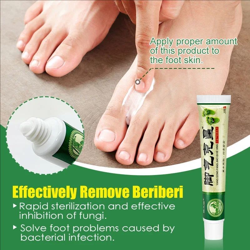 Foot Tinea Pedis Treatment Cream Treat Beriberi Ointment Anti-itch Inhibits Fungus Peeling Athlete Foot Medical Cream A942