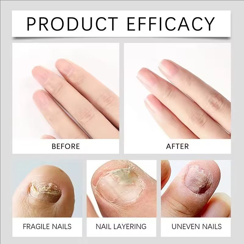Nail Growth Serum Pen Brittled Cracked Nail Care Preventing Dryness And Peeling Cuticle Nutrition Solution Nail Serum New