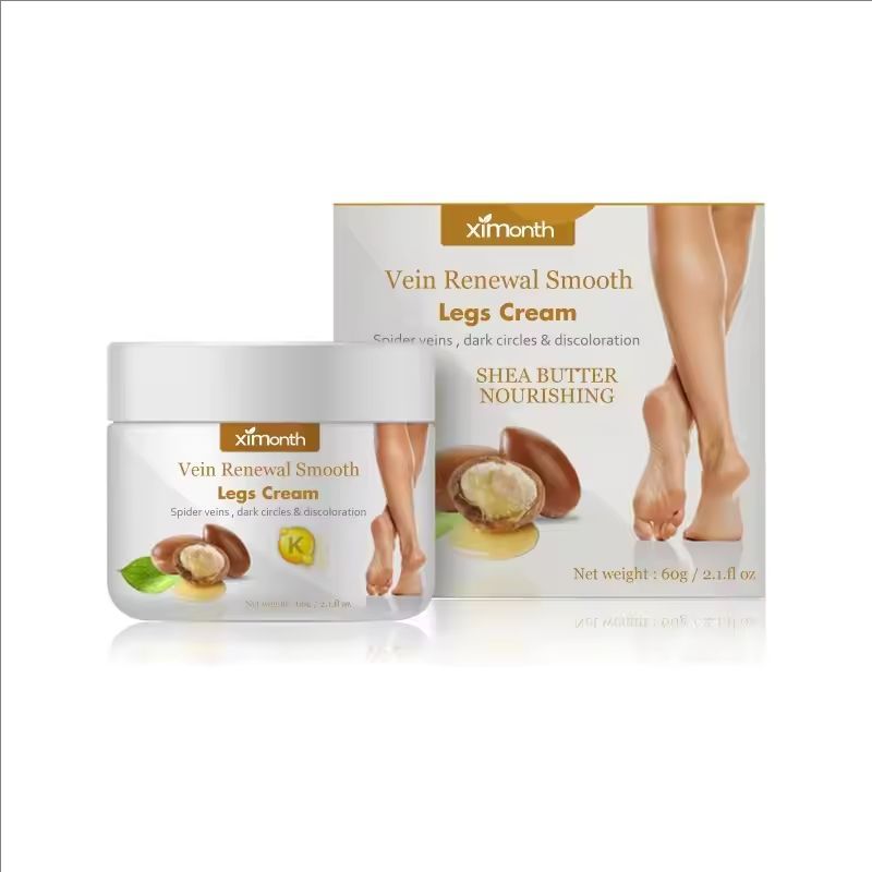Effective Varicose Vein Relief Cream Ointment For Varicose Veins To Relieve Vasculitis Phlebitis Spider Leg sore Pain Treatment