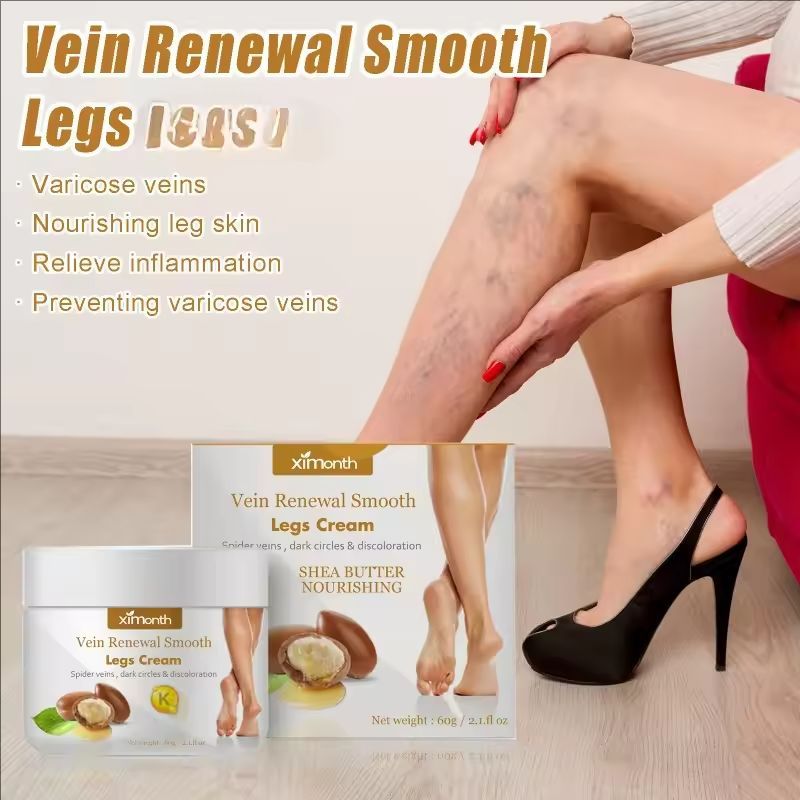 Effective Varicose Vein Relief Cream Ointment For Varicose Veins To Relieve Vasculitis Phlebitis Spider Leg sore Pain Treatment