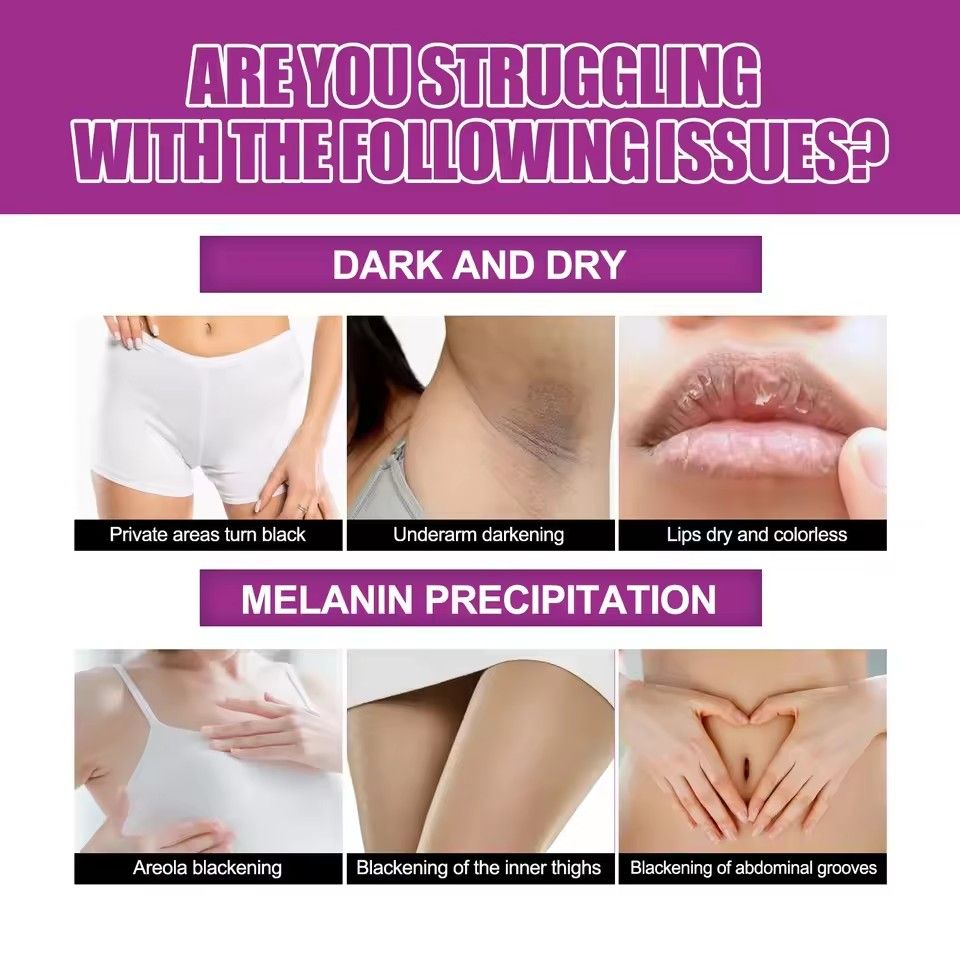Dark Skin Whitening Cream Underarm Leg Knee Elbow Bleaching Lightening Intimate Areas Remove Pigmentation Brighten Skin Care 30g