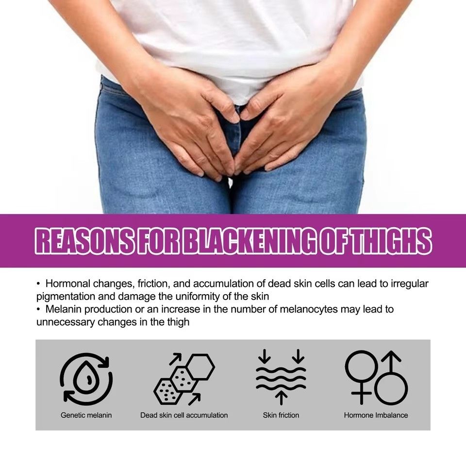 Dark Skin Whitening Cream Underarm Leg Knee Elbow Bleaching Lightening Intimate Areas Remove Pigmentation Brighten Skin Care 30g