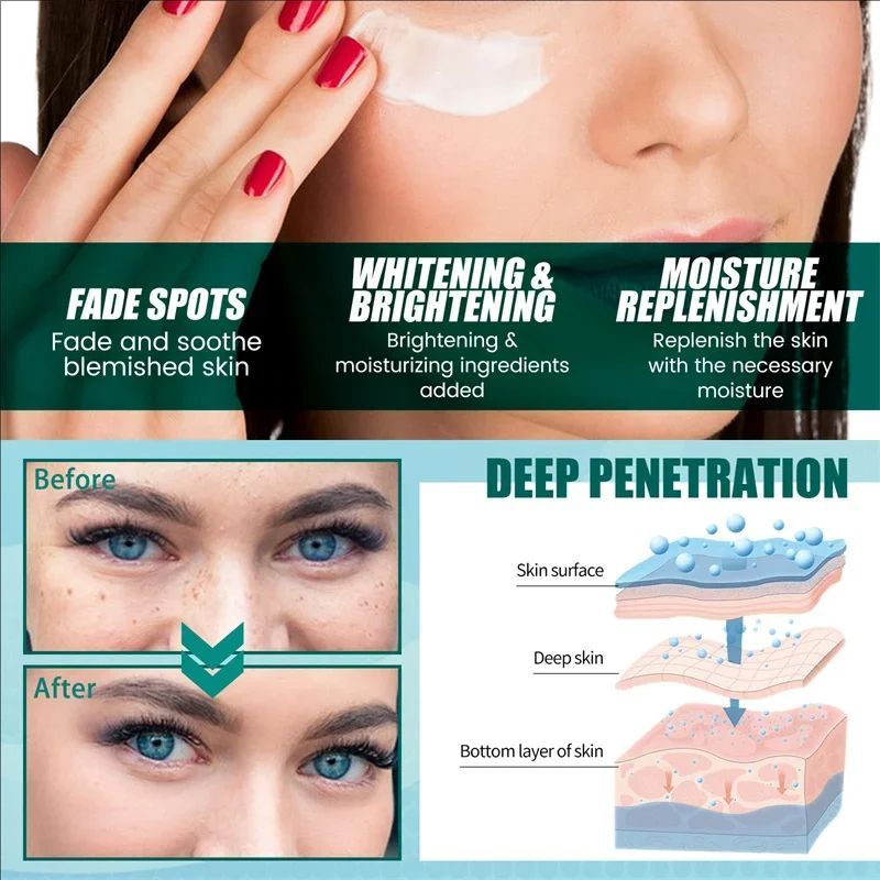Whitening Freckle Cream Melasma Dark Spots Pigmentation Removal Products Fade Stain Melanin Repair Brighten Korean Skin Care