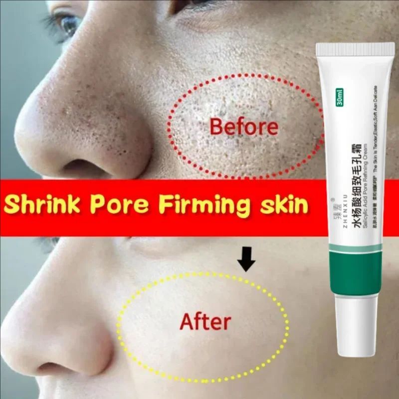 Salicylic Acid Pores Shrink Refining Cream Repair Large Open Pore Removal Black Dots Blackhead Acne Marks Facial Skin Care Serum