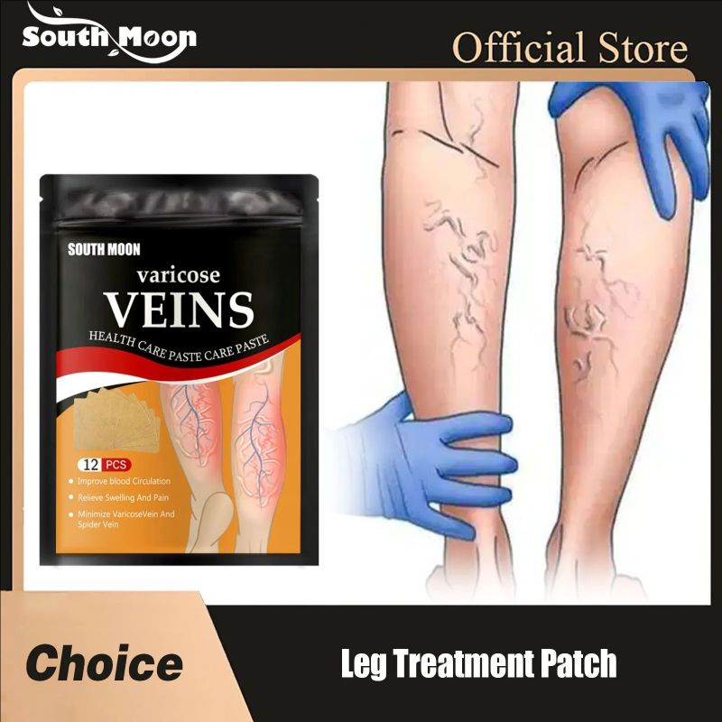 Leg Treatment Patch Improve Varicose Veins Relief Swelling Reduce Phlebitis Blood Circulation Promote Metabolism Body Care Patch