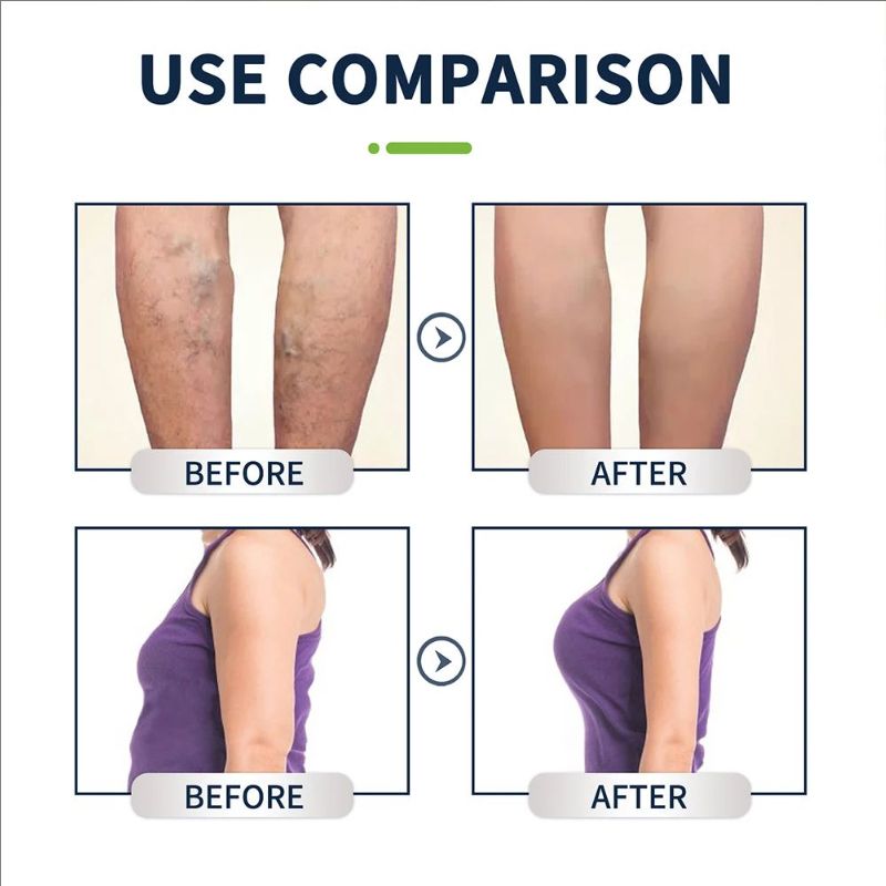 10pcs Oot Cleansing Soak Gel Natural Herbal Foot Bath Gel Dehumidification Detox Relieve Fatigue Repair Leg Veins for Spa Relax