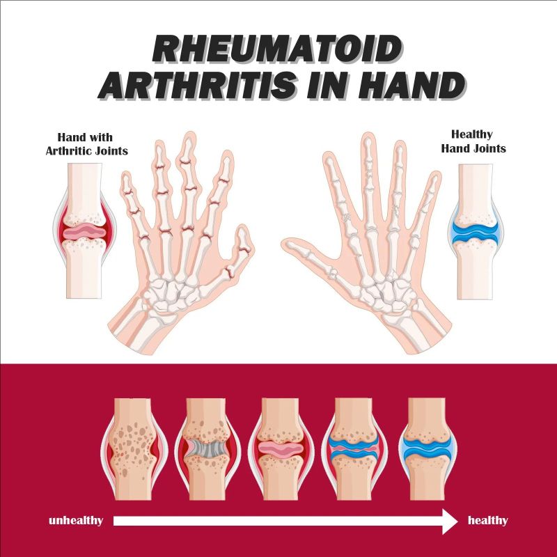 South Moon Joint Bone Collagen Cream Relieves Joint Bone Soreness, Deformations, Corrections, and Repairs