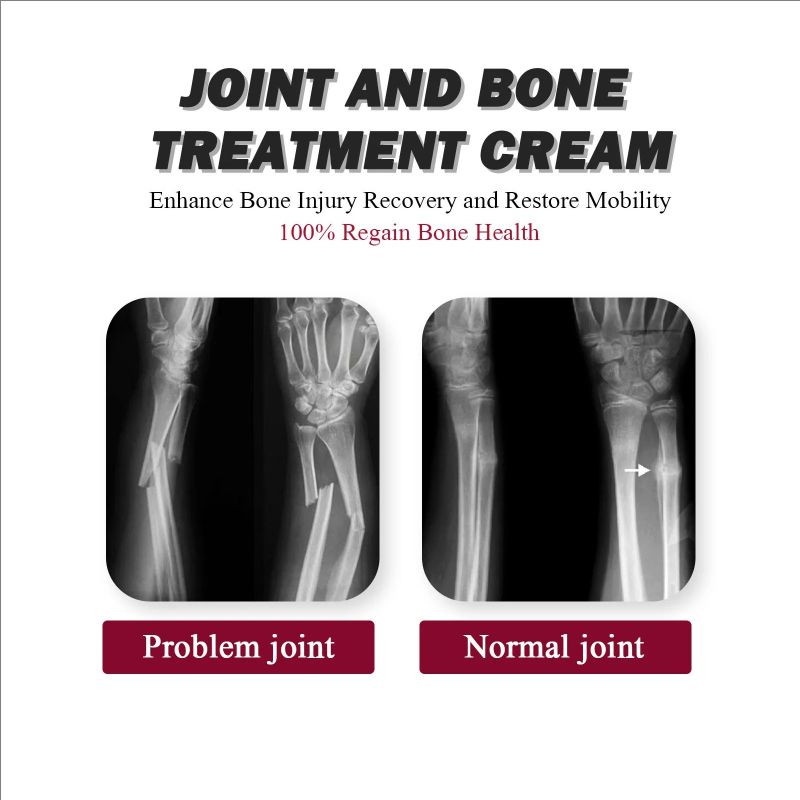 South Moon Joint Bone Collagen Cream Relieves Joint Bone Soreness, Deformations, Corrections, and Repairs