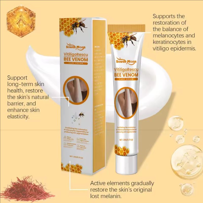 Vitiligo Relief Cream Leukoplakia Mycosis Soothing Ointment Remove White Spots Promote Melanin Production Moisturizing Skin Care