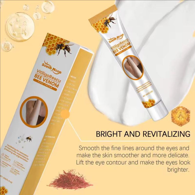 Vitiligo Relief Cream Leukoplakia Mycosis Soothing Ointment Remove White Spots Promote Melanin Production Moisturizing Skin Care