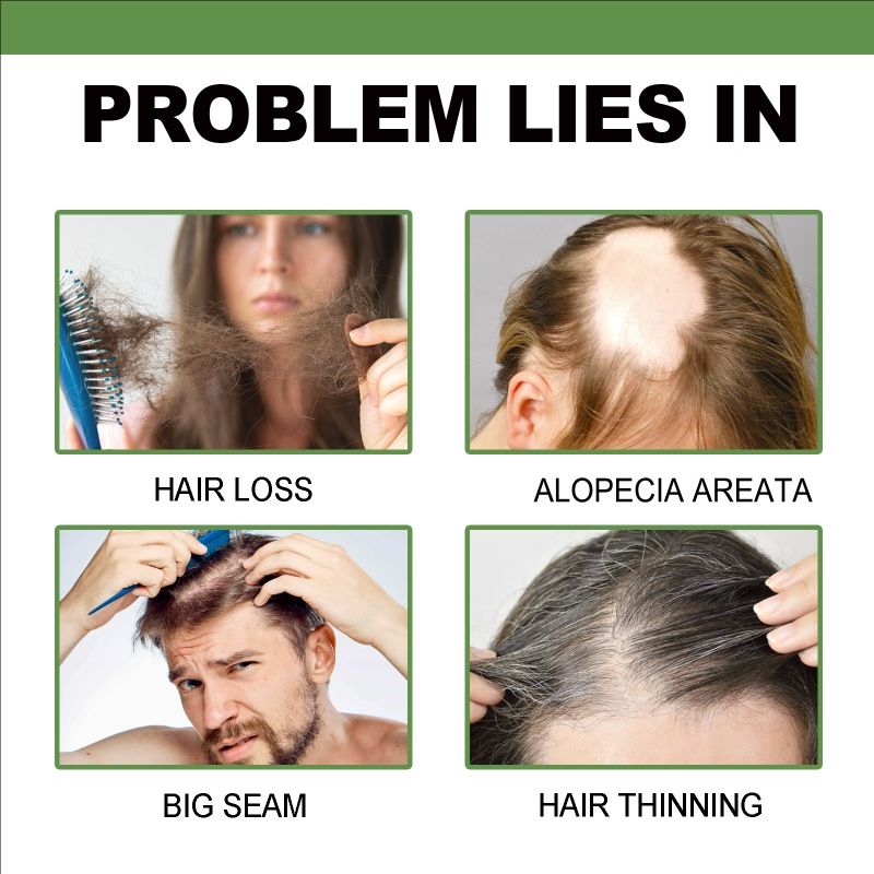 Hair Lotion Hair oil hair serum hair grow Treatment Spray 100% Original 120ml Made In Thailand Essence Oil Hair Loss for Men