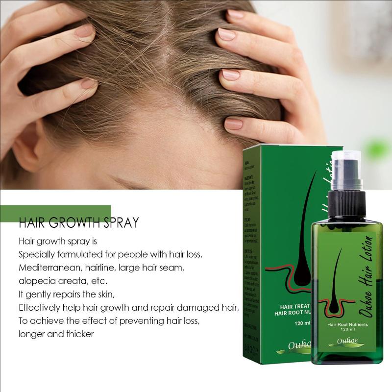 Hair Lotion Hair oil hair serum hair grow Treatment Spray 100% Original 120ml Made In Thailand Essence Oil Hair Loss for Men
