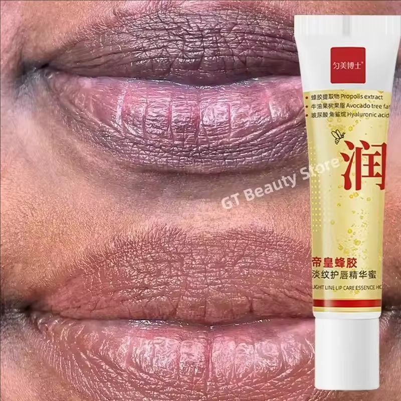 Remove Dark Lip Balm Fast Lightening Pink Lip Exfoliating Fade Lip Line Dead Skin Moisturizer Korean Care Products Beauty Health