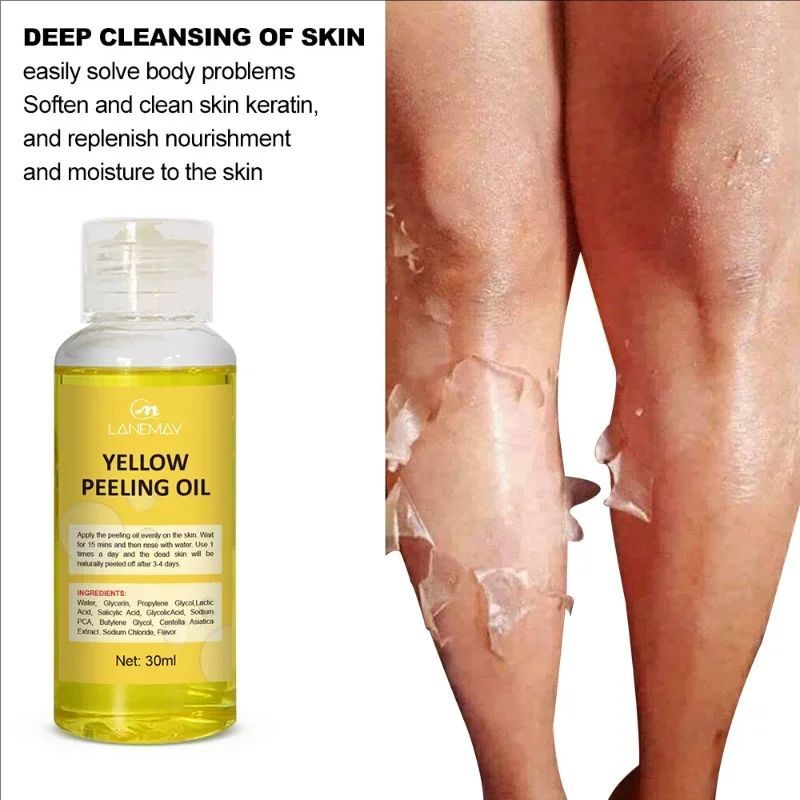 Yellow Exfoliating oil whitening body skin Peeling removal dead skin Dilutes Dark Spot Melanin Moisturizing brightening care