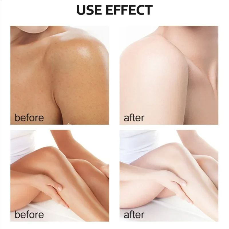 Yellow Exfoliating oil whitening body skin Peeling removal dead skin Dilutes Dark Spot Melanin Moisturizing brightening care