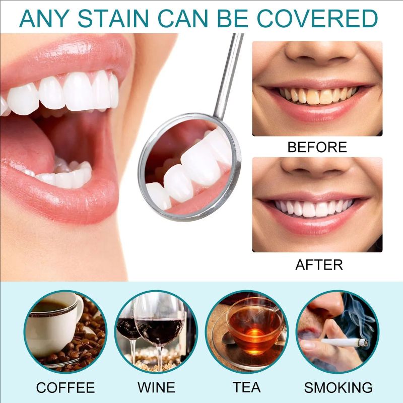 Tooth Paint, Instant Tooth Whitening Paint, Instant Whitening Paint For Teeth, Teeth Stain Remover To Whiten Teeth, Tooth Polish