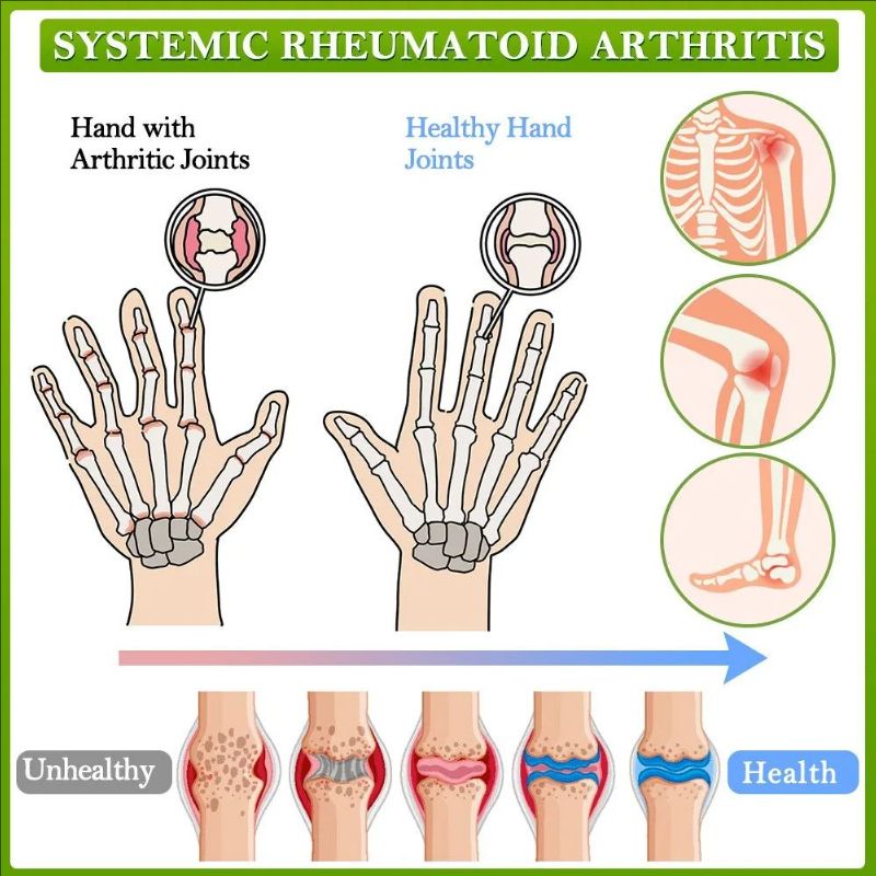 Bee Joint Care Balm Care Lumbar Spine, Knee Muscle Pain, Muscle Soreness, Joint Care Balm（30g）