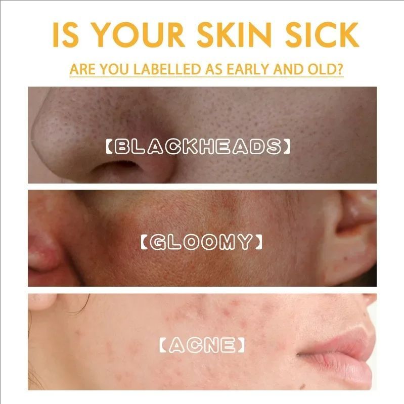 Brightening Peel Off Mask Dark Spots Removal melanin blackhead anti wrinkle firming Remove Freckles skin whitening Moisturizing